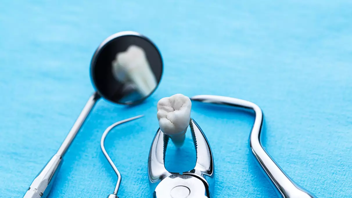 What are the requirements for implant placement immediately after tooth extraction?