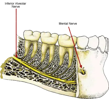 Inferior Alveolar Nerve