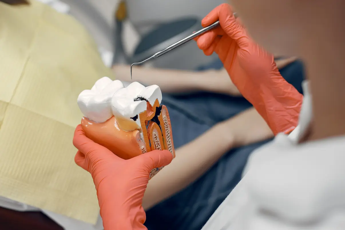 What does a cavity look like?