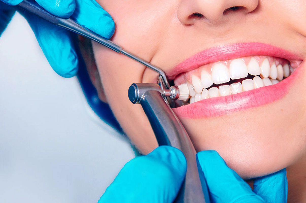 The Importance of Dental Cleanings