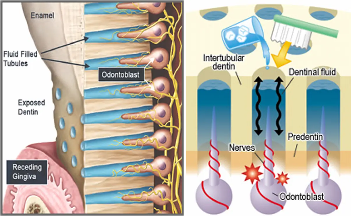What Are Dentin Tubules?