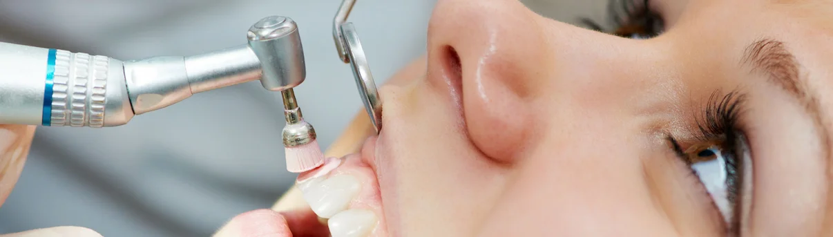 What is Dental Scaling?