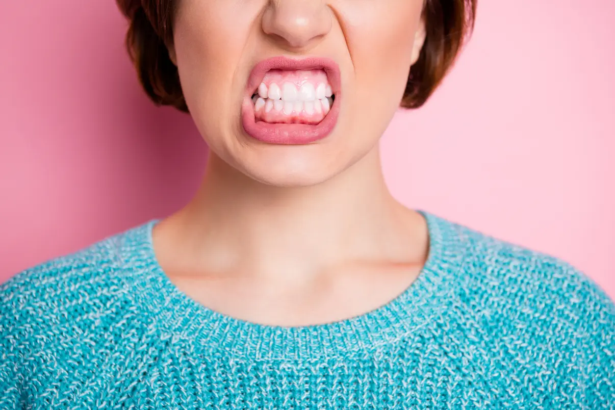 Gum Recession