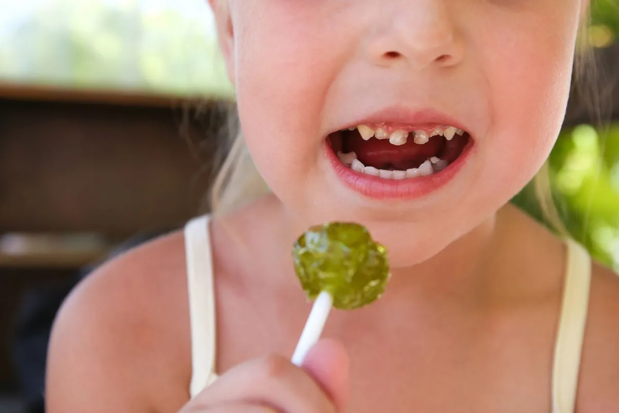 Preventing Tooth Decay